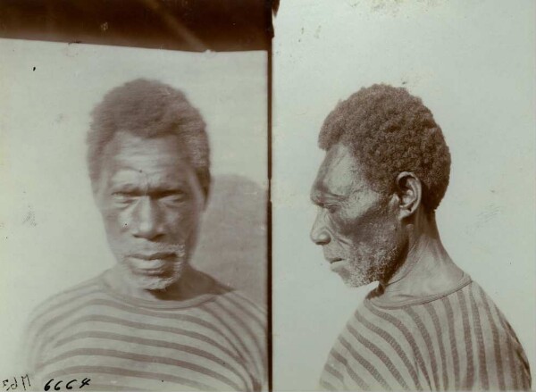 "Man with deformed head. Malekula."