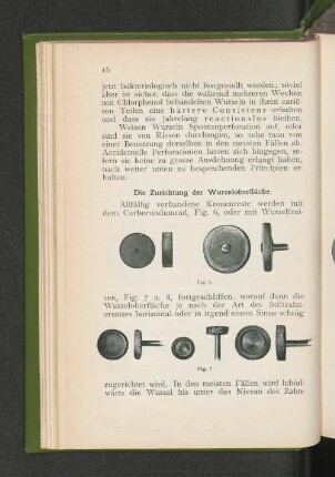 Die Zurichtung der Wurzeloberfläche.