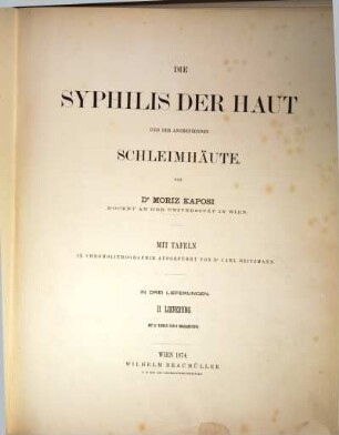 Die Syphilis der Haut und der angrenzenden Schleimhäute, II