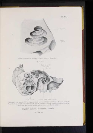 47. Knöcherne Schnecke geöffnet. Lamina spiralis. Vergrößert.