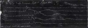 [Graphical recordings: pulse]