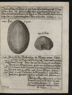 Abblidung der Stein so von dem Ehrwürdigen und Wolgelehrten Herrn M. Johanne Meckhel, [...] Nach dem Tod, äuß der Harnblasen, [...] geschnitten worden.
