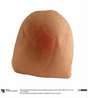 Glatze