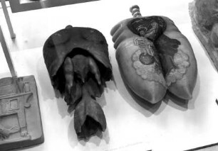 Votivbild eines Brustkorbs mit Lunge und anderen Organen