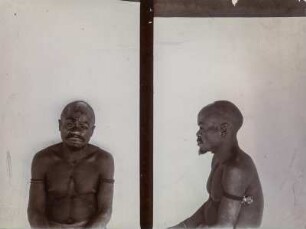 Männerportrait : Anthropometrische Aufnahme eines Mannes