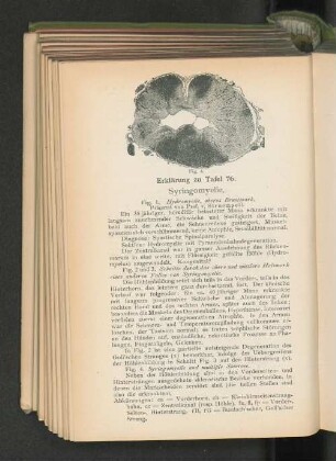 Tab. 76.