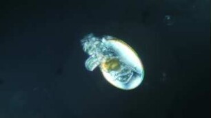 Veliger larva, undetermined, prob. Nudibranchia, Helgoland 2020