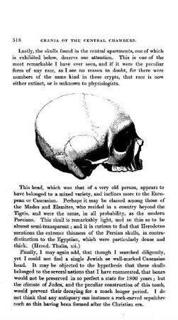 Mixed Varietyof Skull