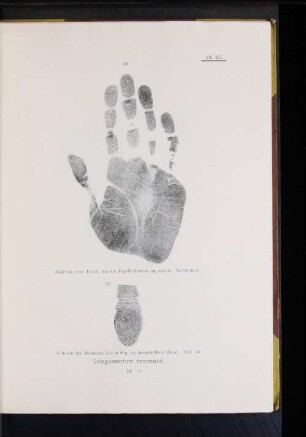 25. Abdruck des Daumens der in Fig. 24 dargestellten Hand. Nat. Gr.
