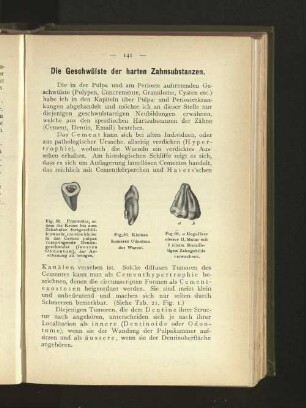 Die Geschwülste der harten Zahnsubstanzen.