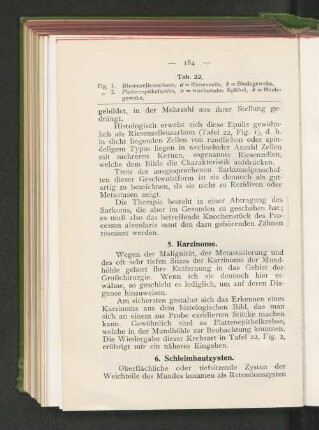 5. Karzinome.