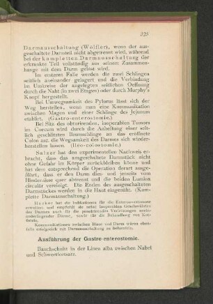 Ausführung der Gastro-enterostomie.