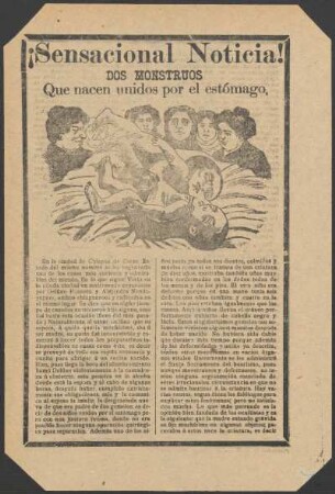 ¡Sensacional Noticia! : dos monstruos que nacen unidos por el estómago