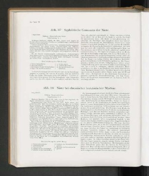 Abb. 118 Niere bei chronischer leukämischer Myelose