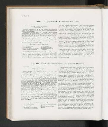 Abb. 118 Niere bei chronischer leukämischer Myelose