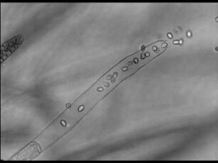 Asexual Reproduction of Saprolegnia mixta (Saprolegniaceae)