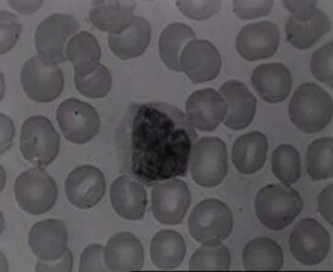 Blood Cells in a Vital Preparation