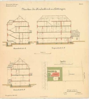 Kinderklinik der Universität Göttingen: Blatt 2, Querschnitt A-B, E-F, Längenschnitt C-D