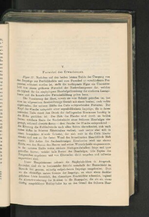 V. Furunkel des Erwachsenen.