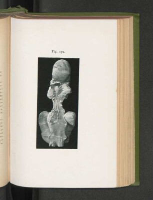 Fig. 172.
