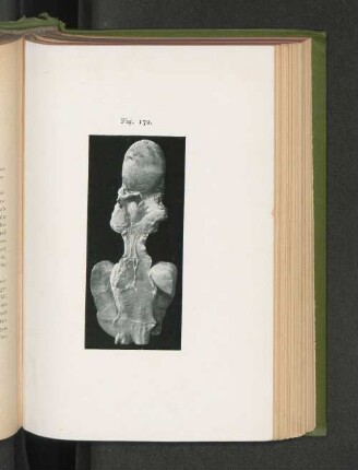 Fig. 172.