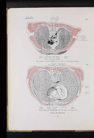 Situs pulmonum.