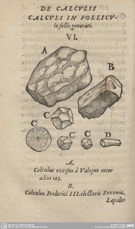 DE CALCULIS CALCULI IN FOLLICULO fellis generati. VI.
