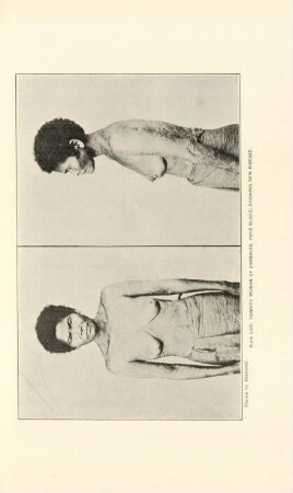 Plate LVIII. Negrito women of Zambales, pure blood, showing skin disease