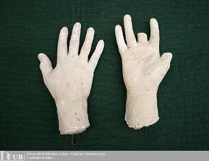 Zwei Gipsabgüsse der rechten Hand von Samuel Thomas von Soemmerring