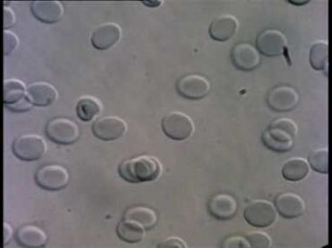 Fluidity of Blood as a Consequence of Fluidity of Erythrocytes