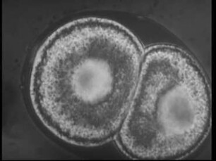 Pelodera strongyloides (Nematodes)