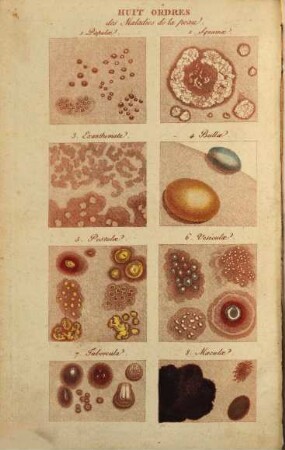 Abrégé pratique des maladies de la peau : classées d'après les système nosologique du D. Willan