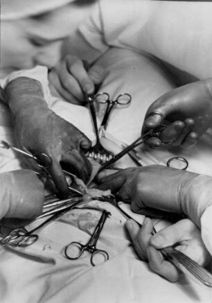 Hamburg. Katholisches Marienkrankenhaus. Während einer Operation. Wird es dem OP-Team gelingen das Krebsgeschwür zu beseitigen ?