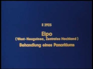 Eipo (West-Neuguinea, Zentrales Hochland) - Behandlung eines Panaritiums