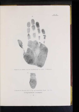 24. Abdruck einer Hand, um die Papillenleisten zu zeigen. Verkleinert.