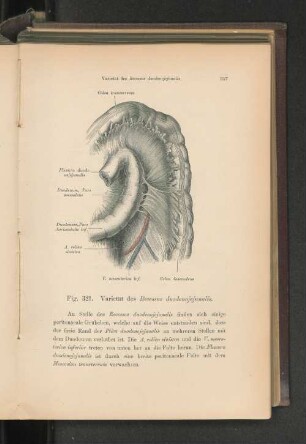 Fig. 321. Varietät des Recessus duodenjejunalis.