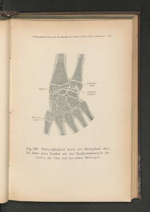 Fig. 578. Horizontalschnitt durch das Handgelenk eines 14 Jahre alten Knaben mit den Epiphysenknorpeln des Radius, der Ulna und des ersten Metacarpus.
