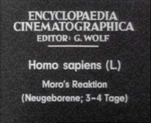 Homo sapiens - Moros Reaktion (Neugeborenes, 3 - 4 Tage)