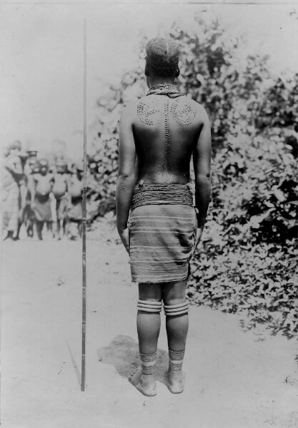 Woman with scar tattoo (rear view)