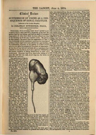 The lancet. 1874, Vol. 2