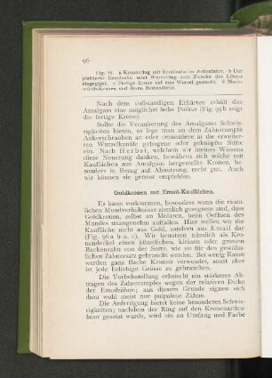 Goldkronen mit Email-Kauflächen.