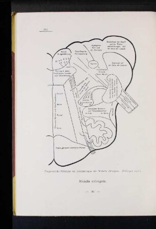 202 Diagnostische Hilfsfigur bei Erkrankungen der Medulla oblongata. (Edinger 1912.)