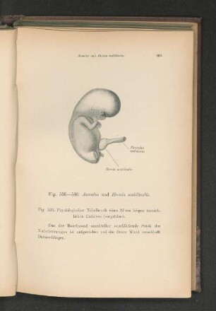 Fig. 536. Physiologischer Nabelbruch eines 27mm langen menschlichen Embryos (vergrößert).