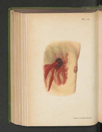 Tab. 19.