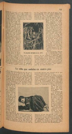 La niña que andaba en cuatro pies