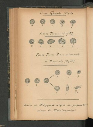 Fig. I-III.