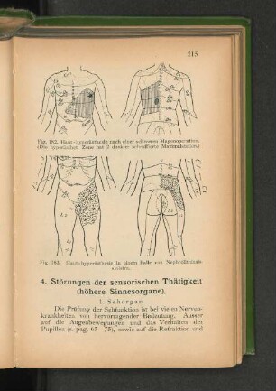 4. Störungen der sensorischen Thätigkeit (höhere Sinnesorgane).