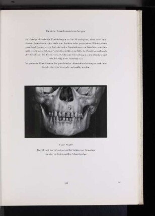Dentale Knochenentzündungen