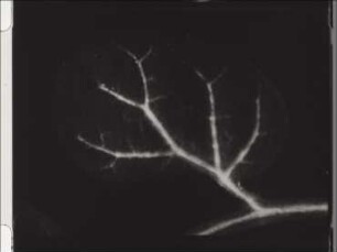 Fascicular and Extrafascicular Water Flow