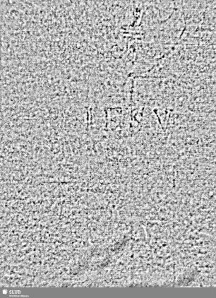 Lilienschild + Buchstaben IESV / Buchstaben LW = Cemb.II: S.17/18